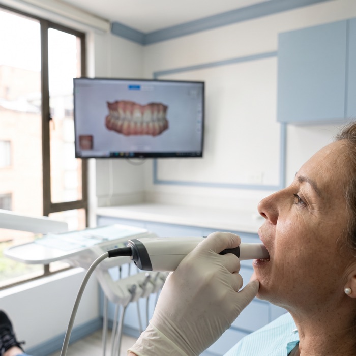 Escáner intraoral: adiós a los moldes